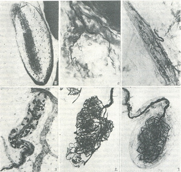 види рецепторів і нервових закінчень