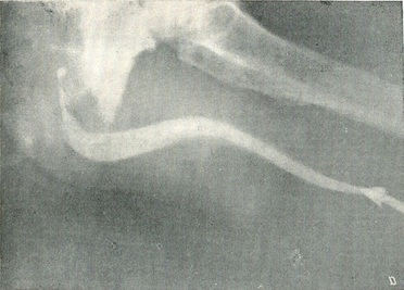 висхідна уретрограмма