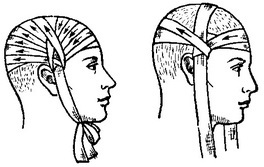 пов'язку «чепчик» на голову