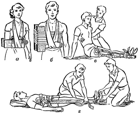 шинні пов'язки