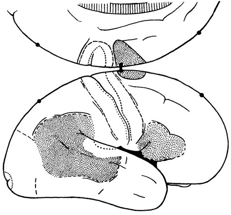 зони коркових мовних механізмів в доминантном півкулі