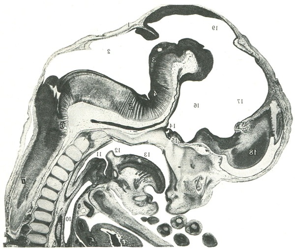 сагітальний розріз ембріона