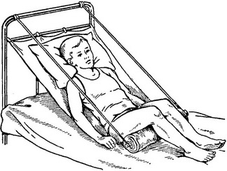 положення хворого в ліжку по Федорову