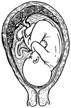 розташування п'ятимісячного плода в матці