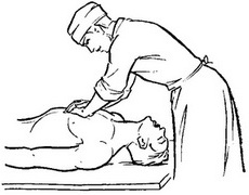 непрямий масаж серця