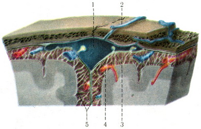 грануляції павутинної оболонки