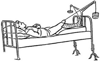 скелетне витягування