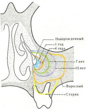 схема вікових змін пазухи верхньої щелепи