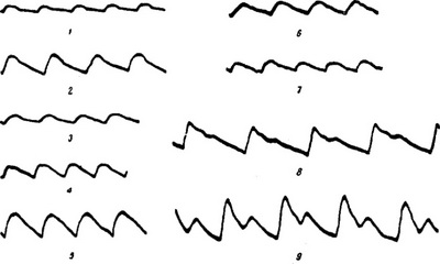 сфигмограмма
