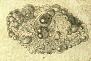 кістозна почк