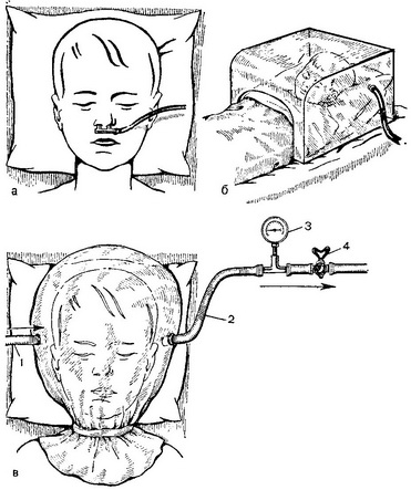 методи інгаляції кисню