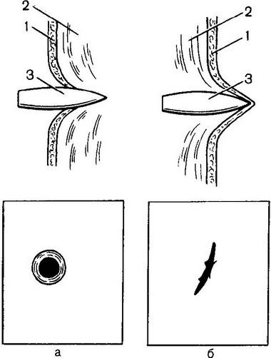 освіта вхідний і вихідний вогнепальних ран