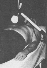 індуктотерапія