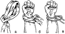 методика фіксації верхніх кінцівок у ліжку