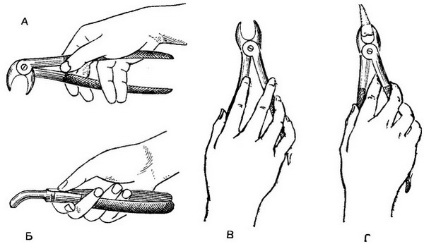 методика видалення зубів