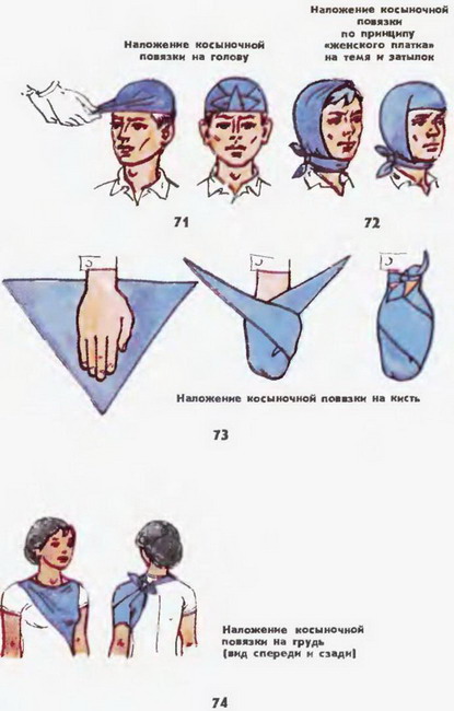 накладення косыночной пов'язки