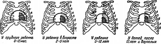 перкуторно межі серця