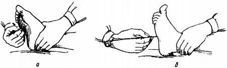 підошовний рефлекс