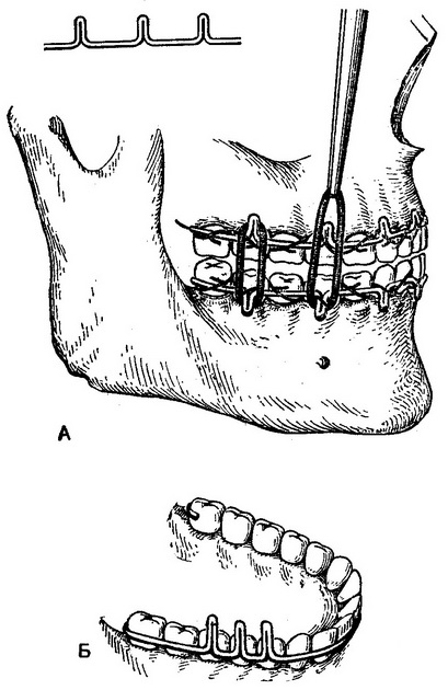 дротові шини
