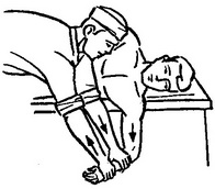 спосіб вправлення вивиху за джанелідзе