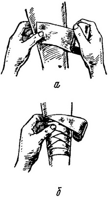 накладення пов'язки на кінцівку