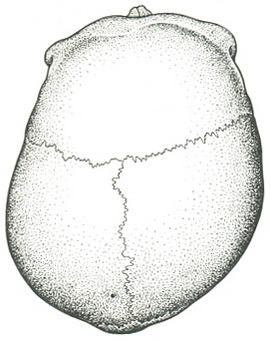 асиметрія черепа