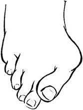 hallux valgus