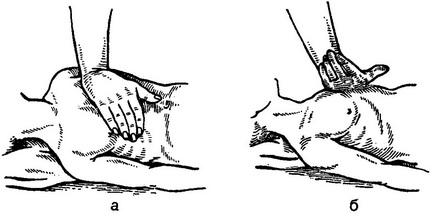 положення рук при закритому масажі серця