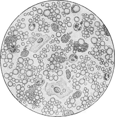 жіноче молозиво під мікроскопом
