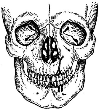 найпростіший метод межчелюстного лігатурного скріплення