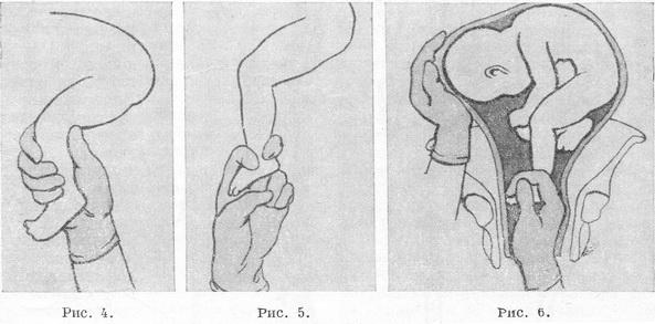 акушерський поворот