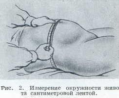  Вимірювання окружності живота сантиметровою стрічкою