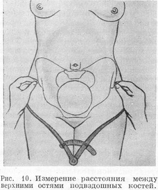 Вимір відстані між верхніми остями клубових кісток