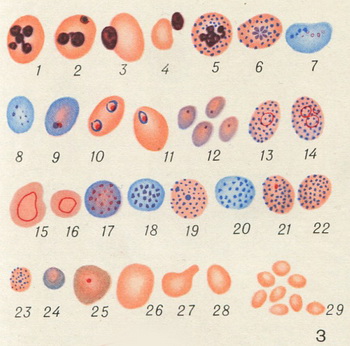 кров при анеміях