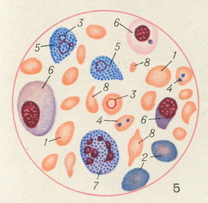 кров при перніциозної анемії
