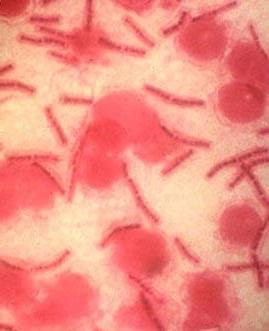 збудник сибірської виразки