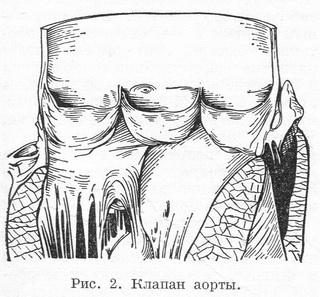 Клапан аорти