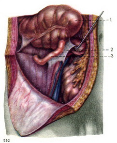 латеральне положення червоподібного відростка