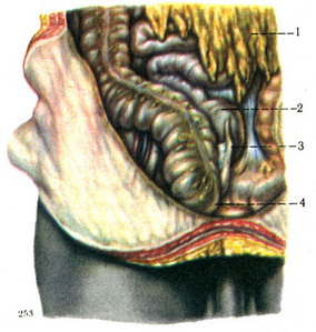 медіальне висхідний напрямок червоподібного відростка