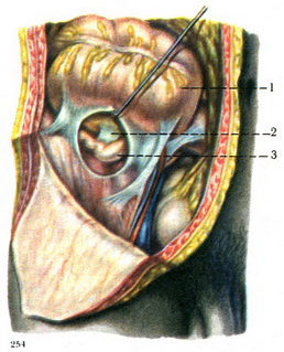 положення червоподібного відростка за сліпою кишкою