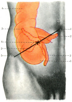 проекція сліпої кишки і червоподібного відростка