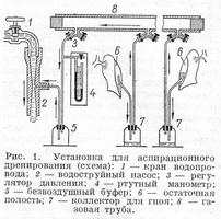 установка для аспіраційного дренування