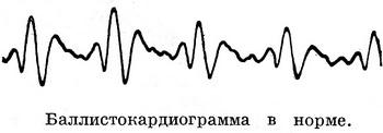 баллистокардиограмма