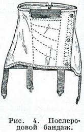 післяпологовий бандаж