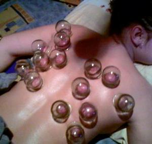 медичні банки