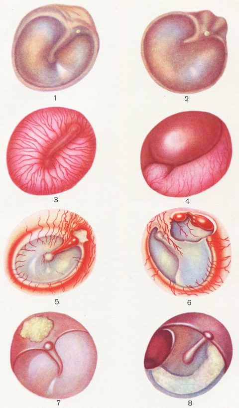 барабанна перетинка