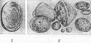 камені сечового міхура