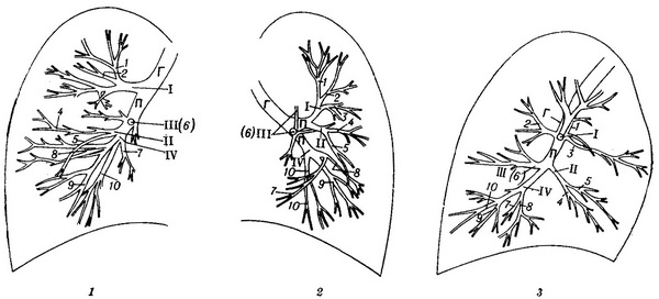 бронхограма схема