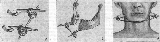 апарат Рудько