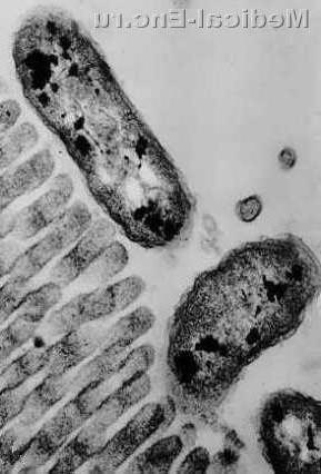 холерний вібріон